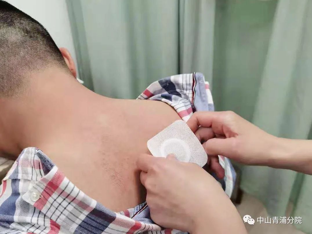 2、江西兒童貼三伏貼癢灼痛，什么體質(zhì)的人可以貼三伏貼癢灼痛？