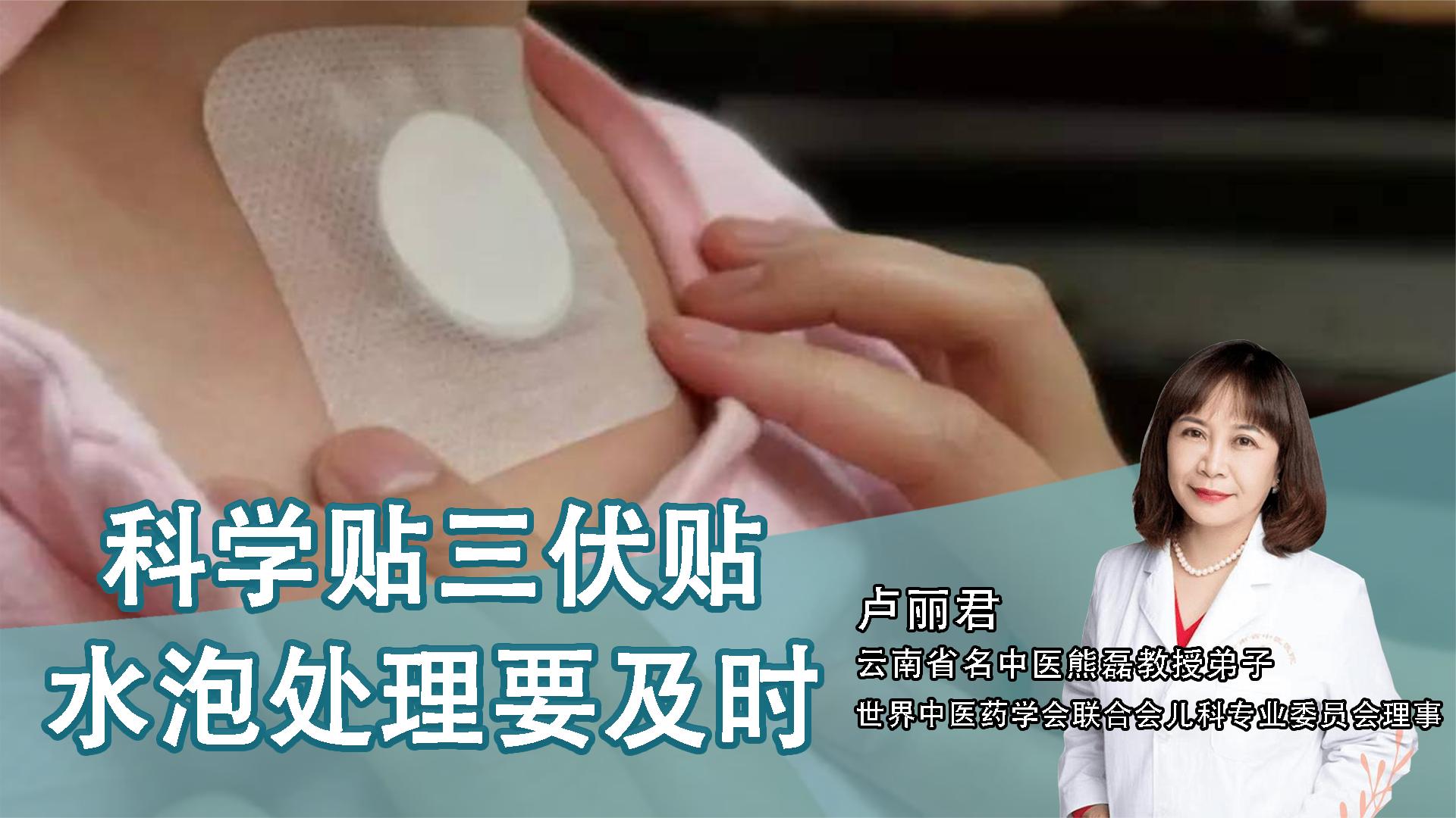 2、貼三伏貼后有什么禁忌？