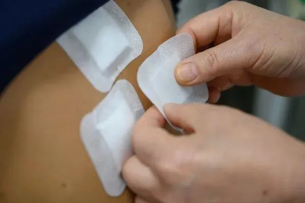 1、三伏貼過敏能擦藥嗎？